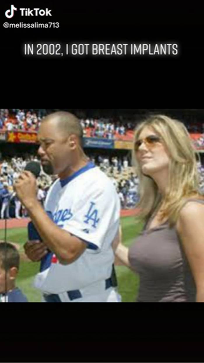 เสริมหน้าอก