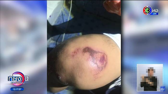 แรมโบ้ นักมวย, รัตน์พล ส. วรพิน