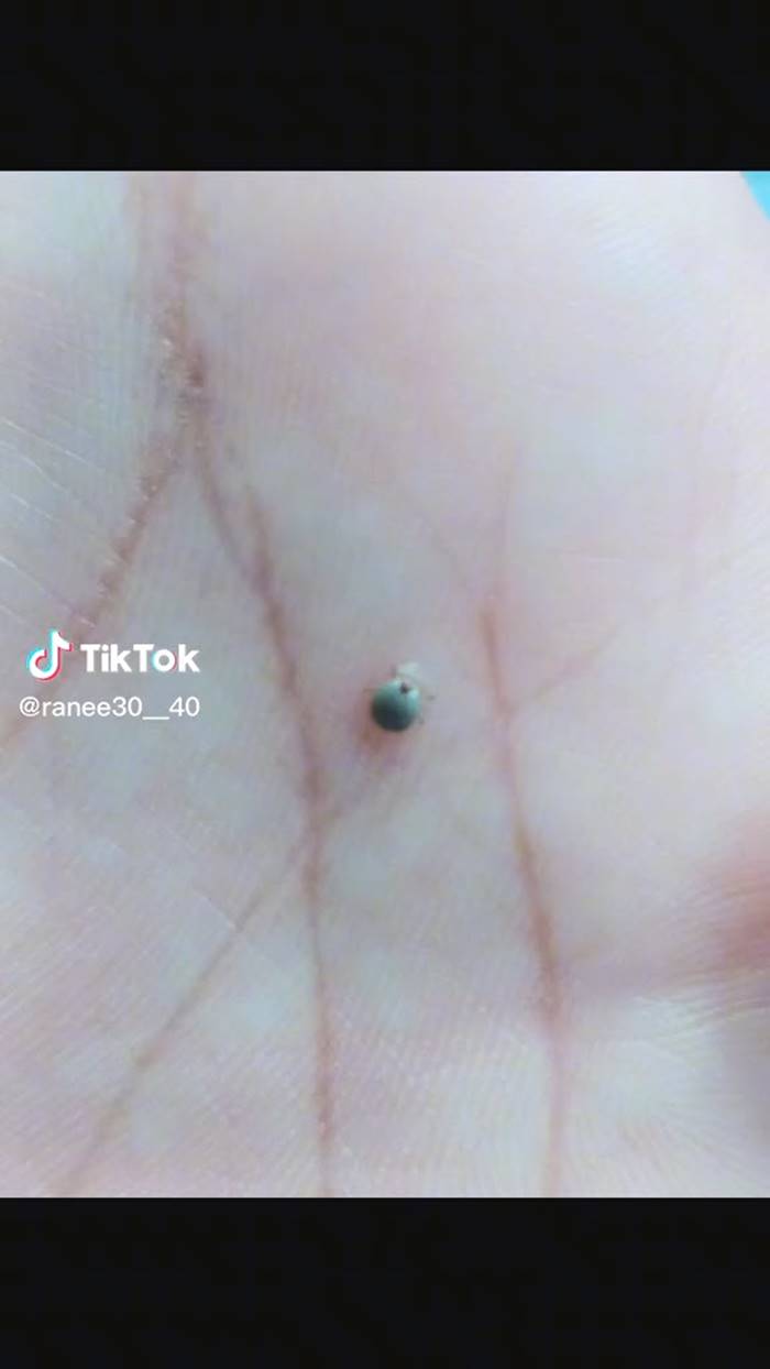 เห็บเกาะตา