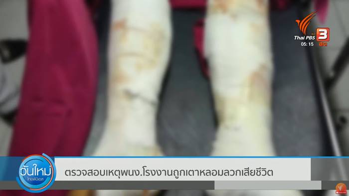 หนุ่มโรงงานถูกลวก