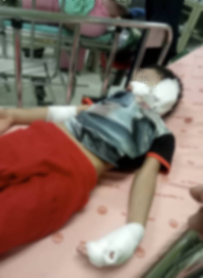 หมากัดเด็ก