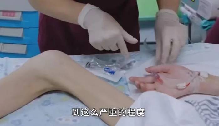 ลดน้ำหนัก