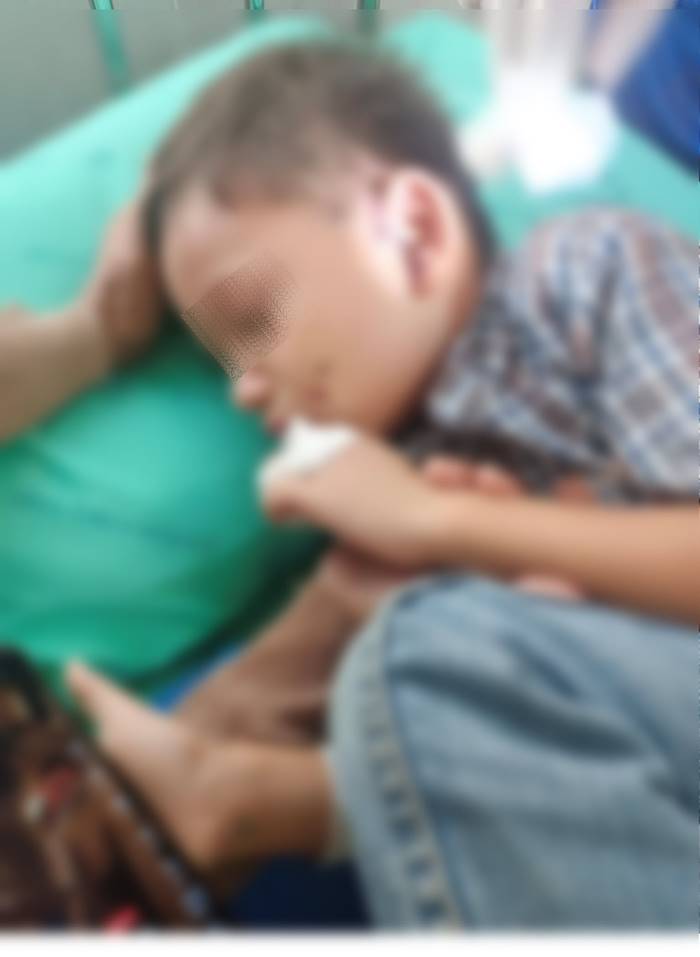 หมากัดเด็ก