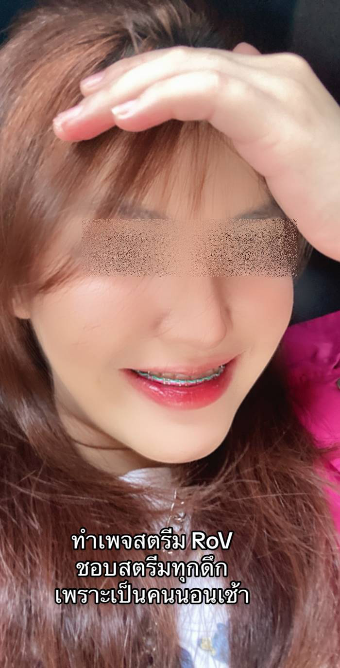 ภูมิคุ้มกันบกพร่อง