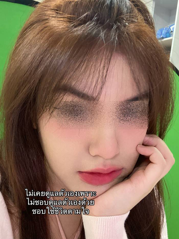 ภูมิคุ้มกันบกพร่อง