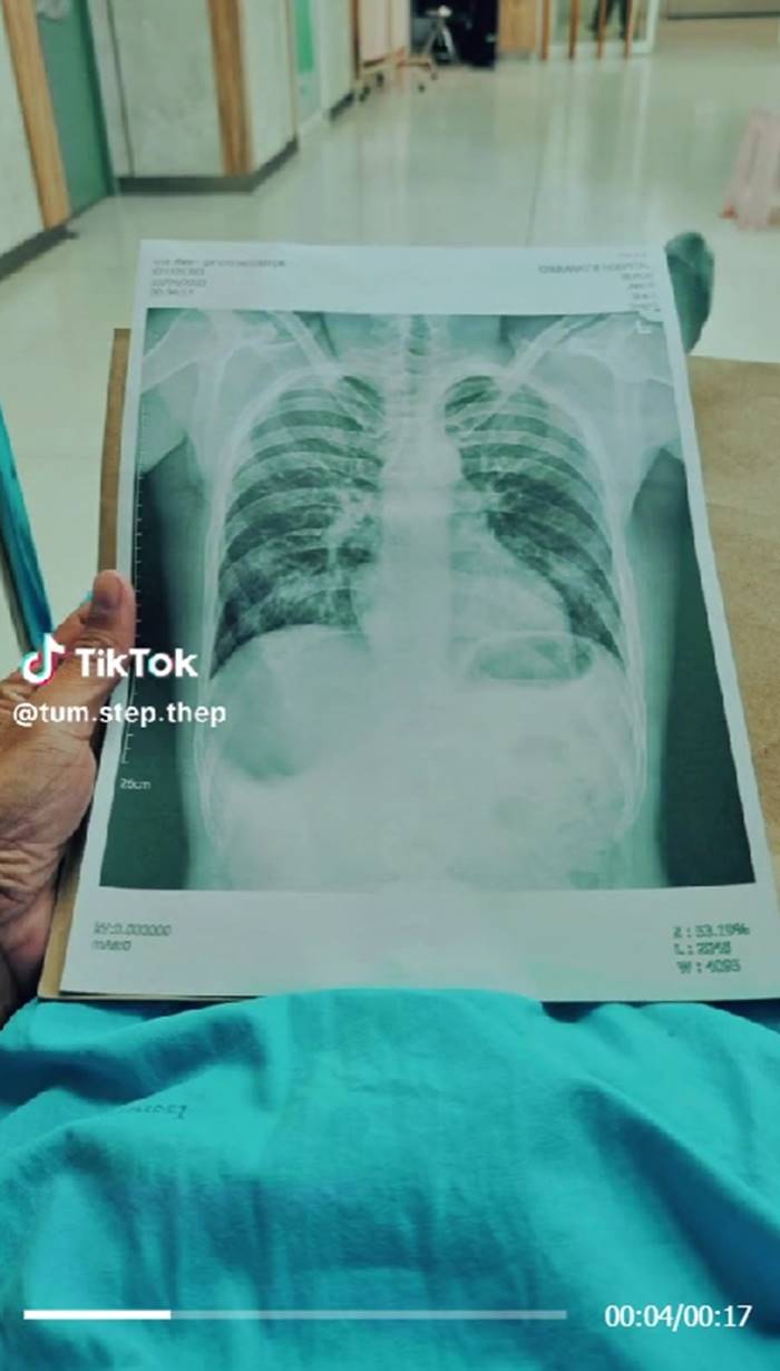 บุหรี่ไฟฟ้า