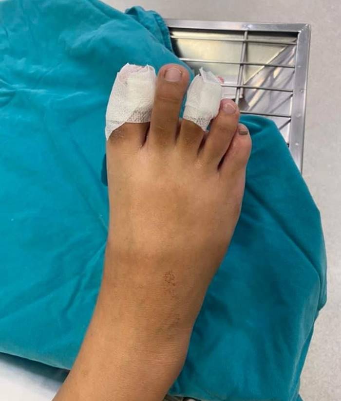  หมากัดคน