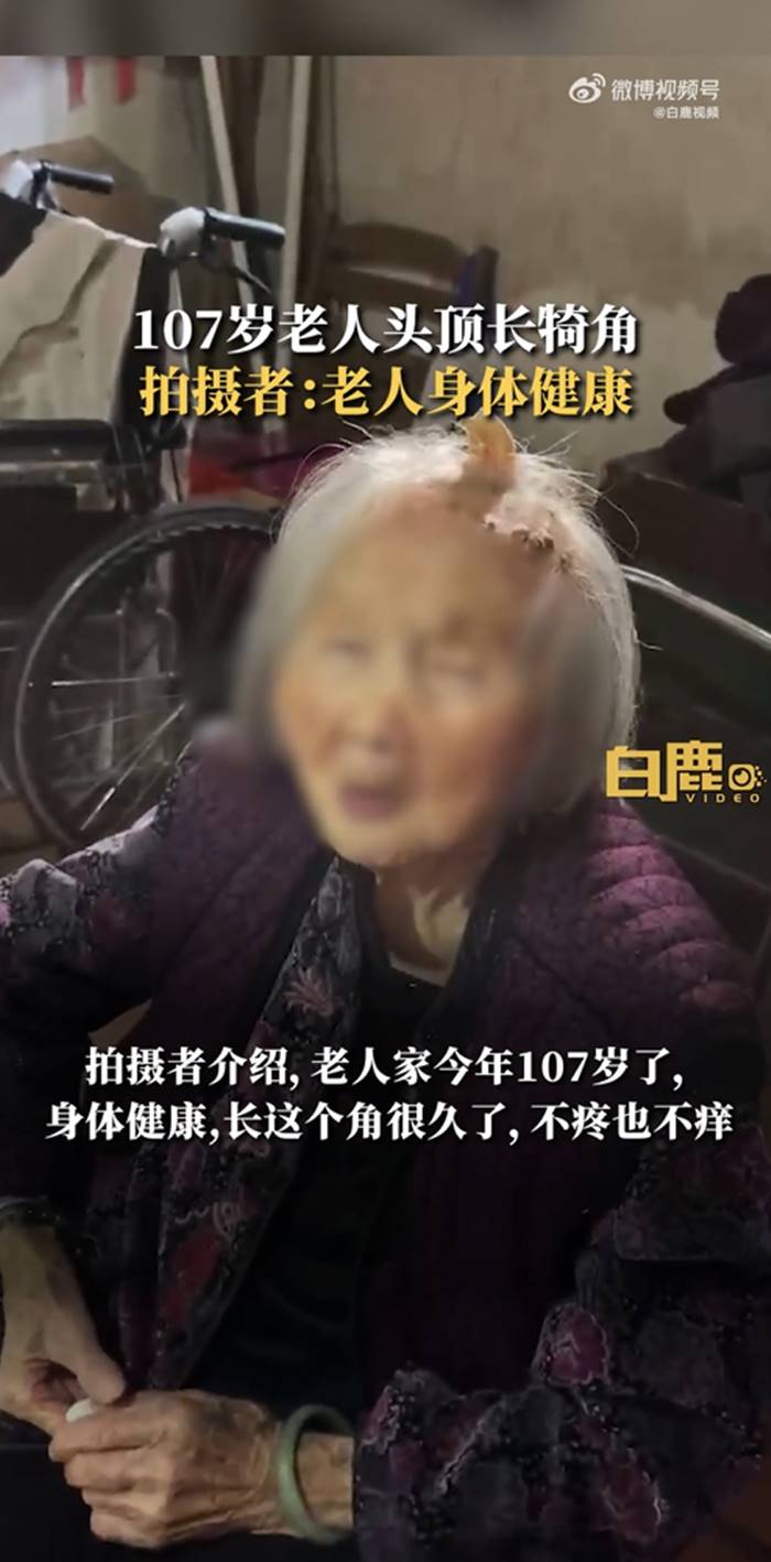 เนื้องอก