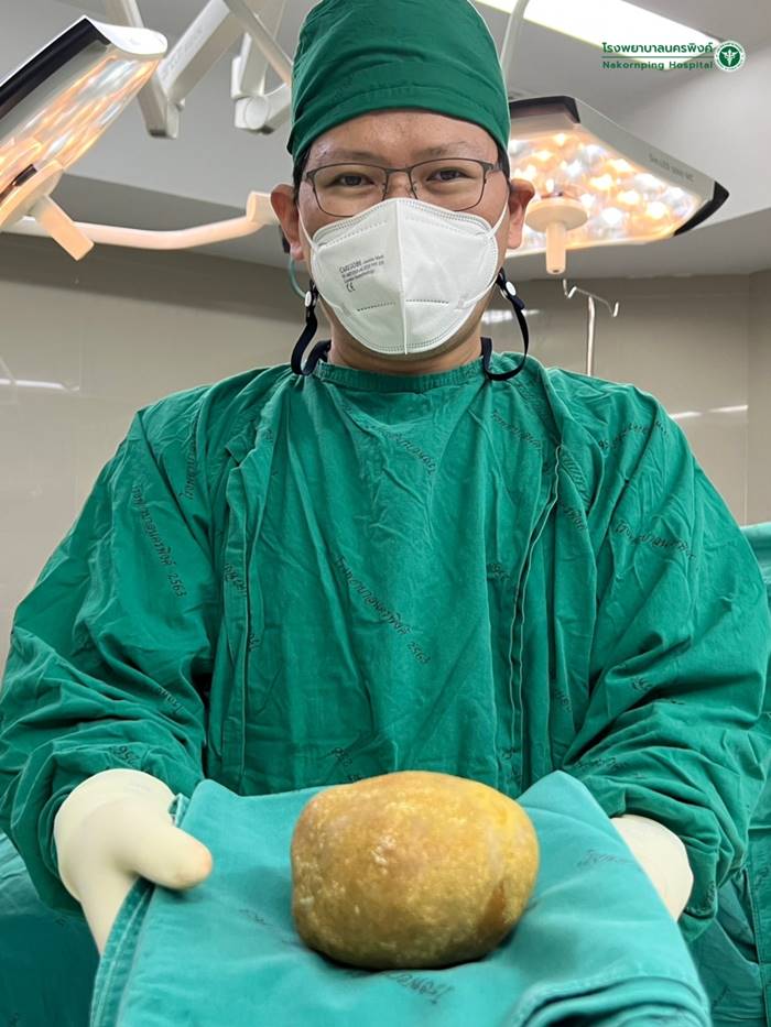 นิ่วในกระเพาะปัสสาวะ