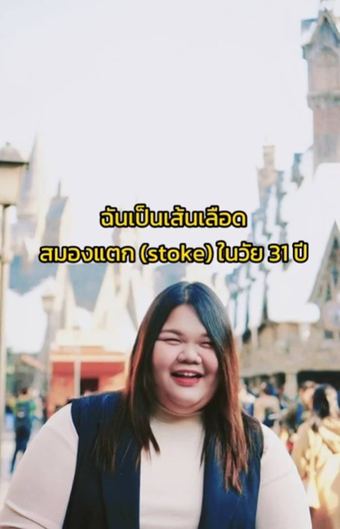 เส้นเลือดในสมองแตก