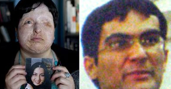 อิหร่านโหด ลงดาบคนร้ายสาดน้ำกรดด้วยการควักลูกตา-ตัดหูทิ้ง 