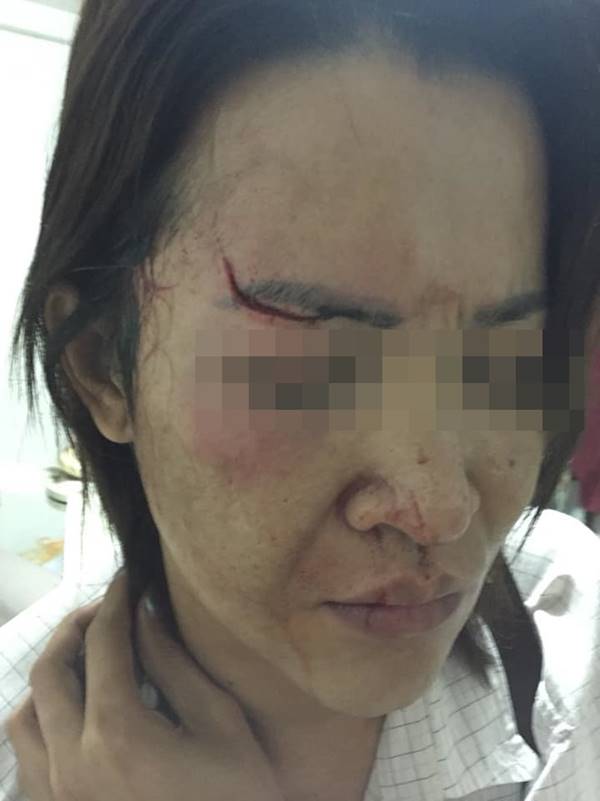 เตือนระวัง