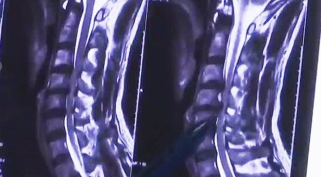 นอนเล่นมือถือผิดท่า