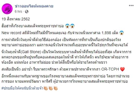 นิ่วในถุงน้ำดี