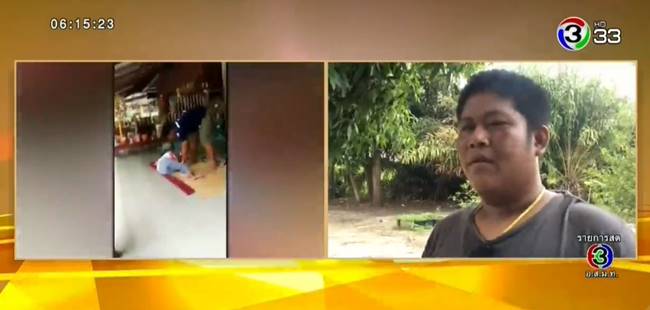 เหยียบคนไข้ขาหัก