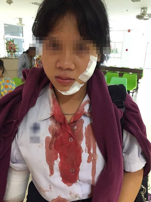  เด็กทะเลาะกัน