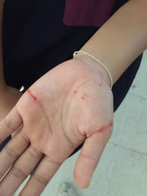  เด็กทะเลาะกัน