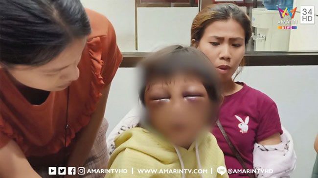 แม่ตีลูกตาปิด