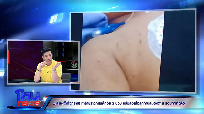 ทำร้ายเด็ก