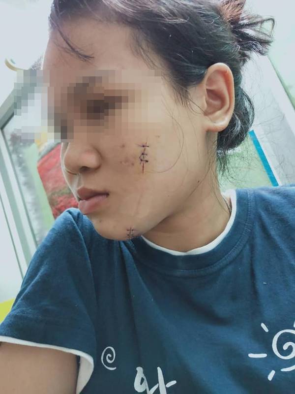  เด็กทะเลาะกัน