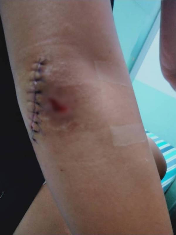  เด็กทะเลาะกัน