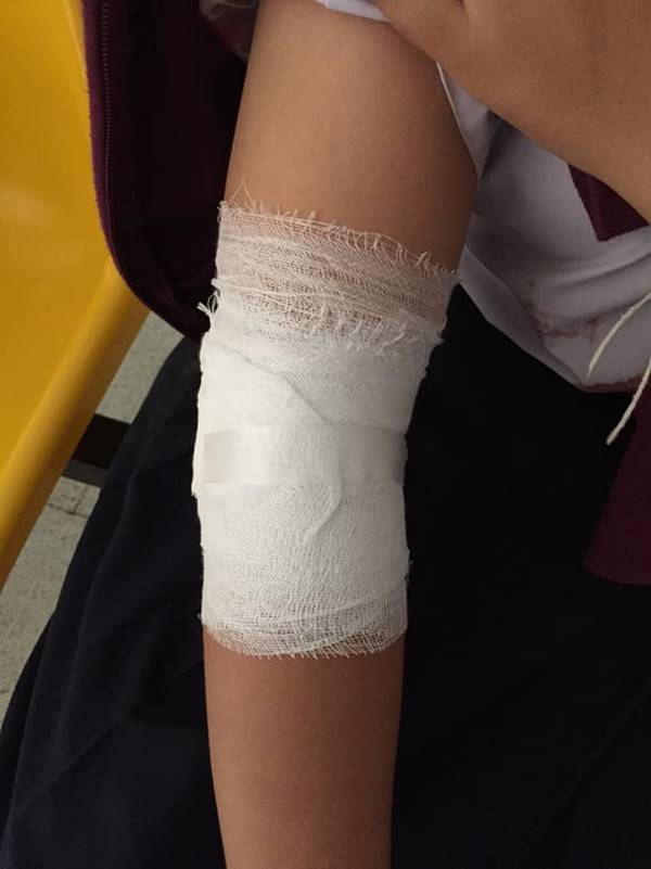  เด็กทะเลาะกัน