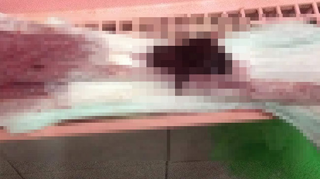 ประจำเดือนมาผิดปกติ