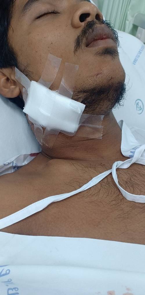 ปลาเต็กเล้ง 