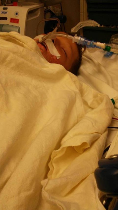 ช็อก เด็กชาย 10 ขวบถูกเพื่อนราดน้ำมัน-จุดไฟเผา ขณะเล่นด้วยกัน