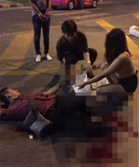 หนุ่มถูกแท็กซี่เฉี่ยวจนขาขาด 