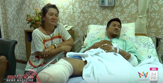 หนุ่มถูกแท็กซี่เฉี่ยวจนขาขาด 