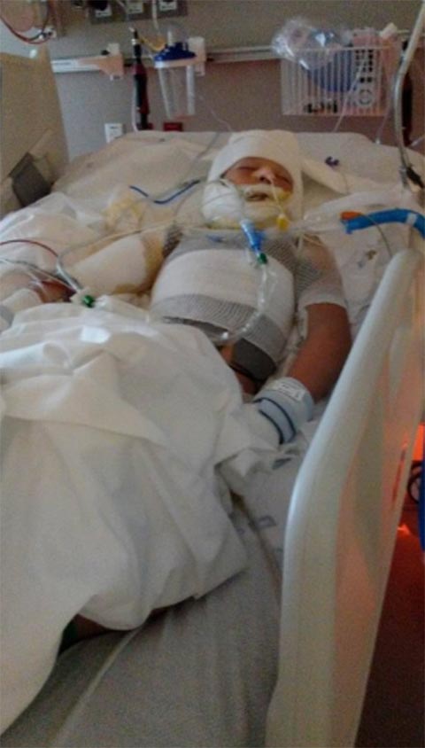 ช็อก เด็กชาย 10 ขวบถูกเพื่อนราดน้ำมัน-จุดไฟเผา ขณะเล่นด้วยกันช็อก เด็กชาย 10 ขวบถูกเพื่อนราดน้ำมัน-จุดไฟเผา ขณะเล่นด้วยกัน