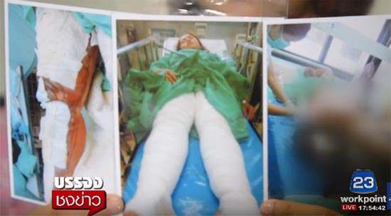 2 แม่ลูกรุมทำร้ายแม่ค้าชานม