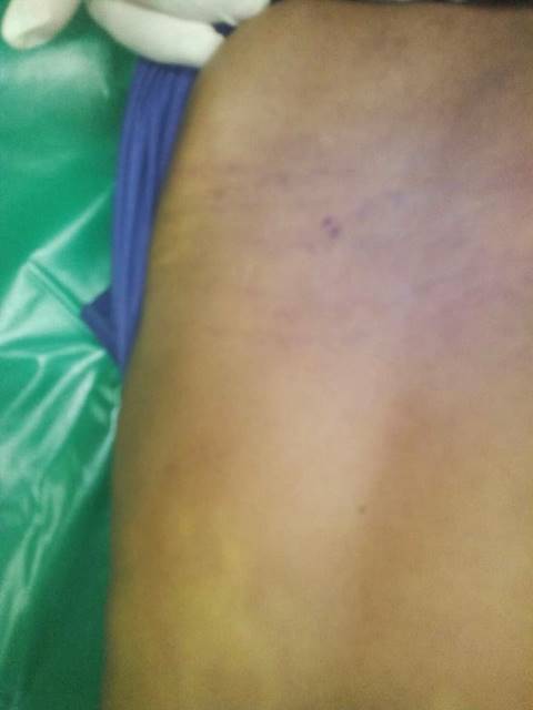 น้องเมยไม่ใช่ศพสุดท้าย