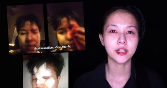  ดีเจทอมใช้แก้วทุบหน้าน้องบล็อกเกอร์