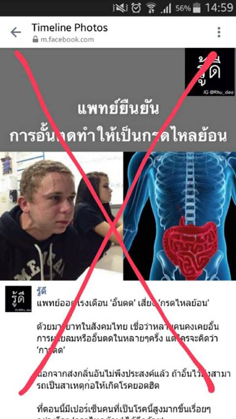 อย่าแชร์มั่ว ! อ.เจษฎา ยันการอั้นตด ไม่ใช่สาเหตุที่ทำให้เป็นกรดไหลย้อน 