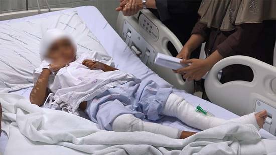 เด็กหญิงวัย 6 ขวบ โดนน้ำมันร้อนราดใส่ตัว เจ็บนานนับเดือน คู่กรณีเยี่ยมครั้งเดียว