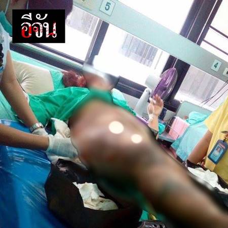 2 แม่ลูกเอาน้ำมันร้อน ๆ ราด 