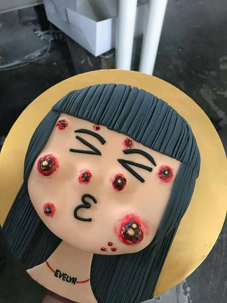  เค้กบีบสิว