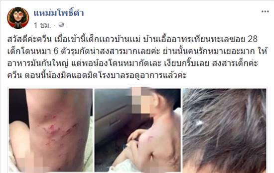 หมากัดเด็ก