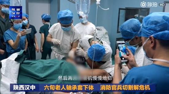 คลิปปฏิบัติการระทึก แพทย์-กู้ภัยระดมกำลังช่วยลุง หลังทำห่วงเหล็กติดเจ้าโลก