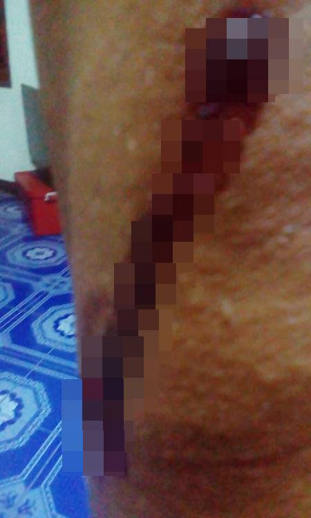 ช้ำใจ ! ตาน้องกัปตันเผยถูกลูกเขยทำร้าย