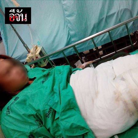 2 แม่ลูกเอาน้ำมันร้อน ๆ ราด 