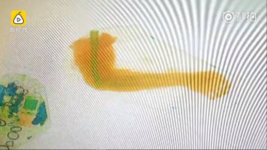 เจ้าหน้าที่ขนส่งสแกนเจอแขนมนุษย์ 