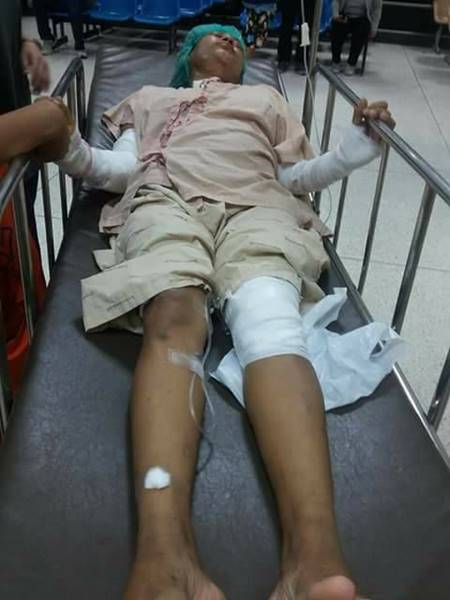 ดักสาดน้ำกรด