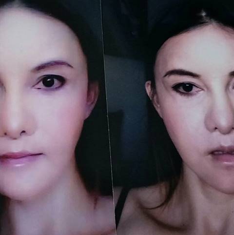 ศัลยกรรมทำพิษ