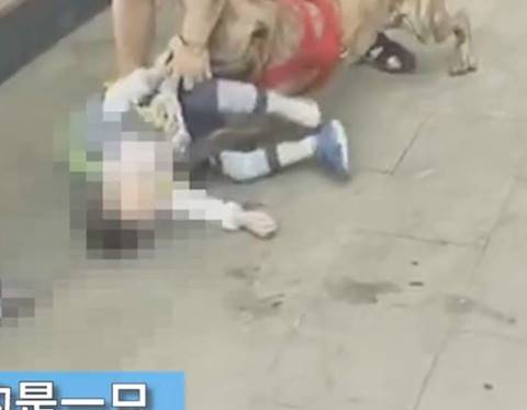 พิทบูลกัดเด็ก 