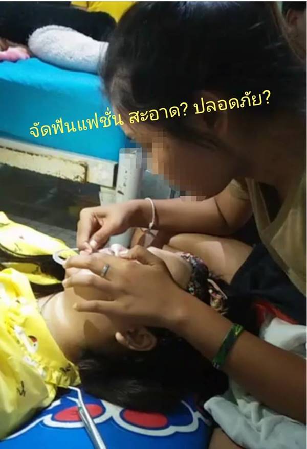 จัดฟันแฟชั่น