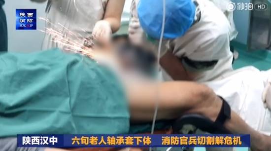 คลิปปฏิบัติการระทึก แพทย์-กู้ภัยระดมกำลังช่วยลุง หลังทำห่วงเหล็กติดเจ้าโลก