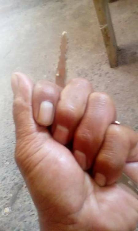 ช้ำใจ ! ตาน้องกัปตันเผยถูกลูกเขยทำร้าย